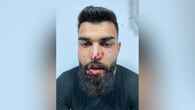 Gözaltında darp edilen Gül: 'Pardon, sen değilmişsin, şikayetçi olma' dediler