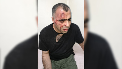 Gazeteci Sinan Aygül'e saldırı: Polis ve belediye personeli gözaltına alındı