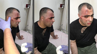 Darp edilen gazeteci Aygül'den, 'helalleştik' diyen belediye başkanına: Benim davam devam ediyor
