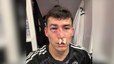 Beşiktaş sakatlanan Bahtiyar Zaynutdinov'u paylaştı: 'Yorumsuz'