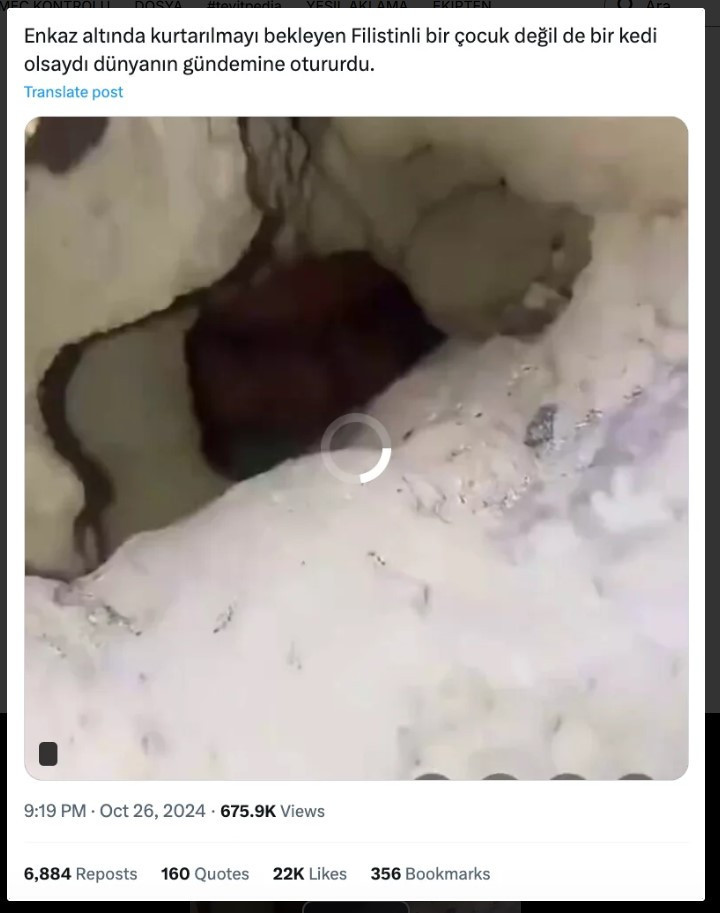 Videodaki çocuk gerçekten Gazze'de mi? - Resim : 1