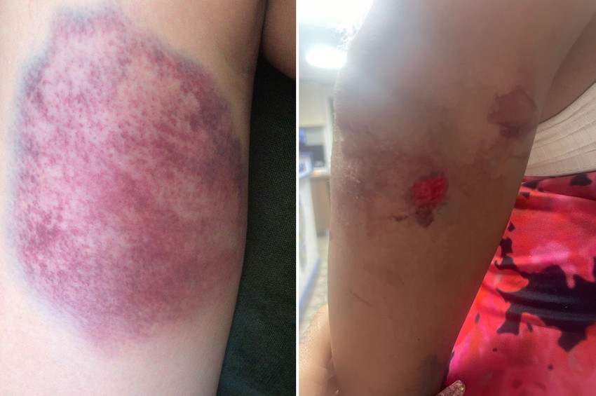 İzmir'de yolda sohbet eden trans kadınlar darp edilerek gözaltına alındı - Resim : 1