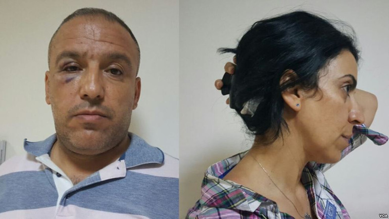 Mardin'de 3 gazeteciye saldırı