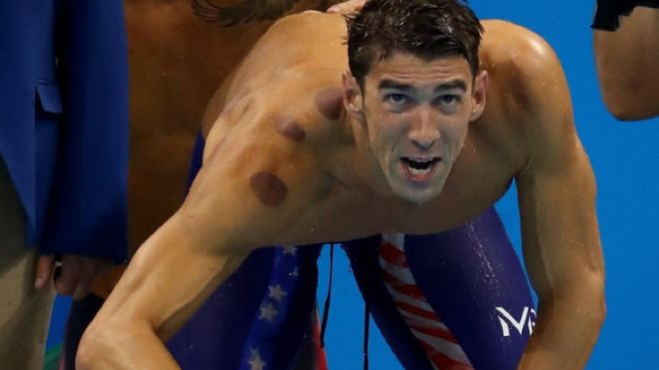 Olimpik sporcular neden bardak çektiriyor?