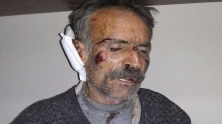 Koruköy'de işkence gördüğü iddia edilen köylü tutuklandı