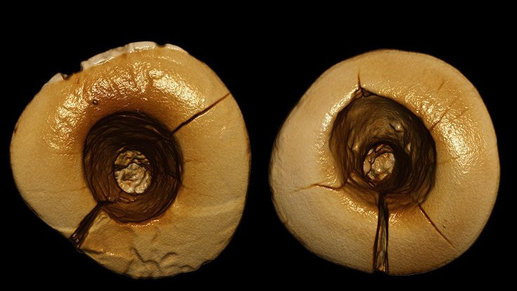 Dünyadaki en eski diş dolgusu, buz devrinde İtalya'da yapıldı
