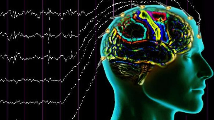 Epilepsi Derneği: Korkmadan tedaviye devam edin