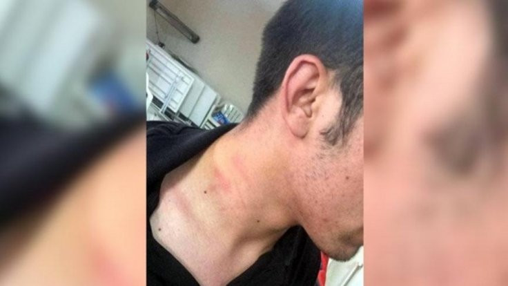 AK Partili vekil CHP'li gencin boğazını sıktı