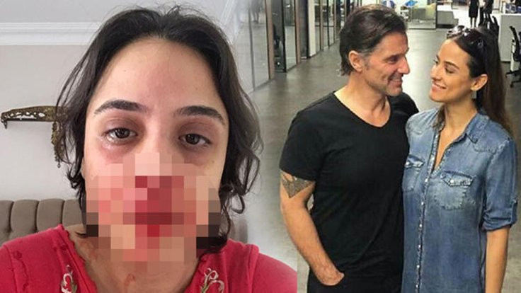 Zeynep Tandoğan şiddet iddiasıyla oyuncu Hazım Körmükçü'den ayrıldı