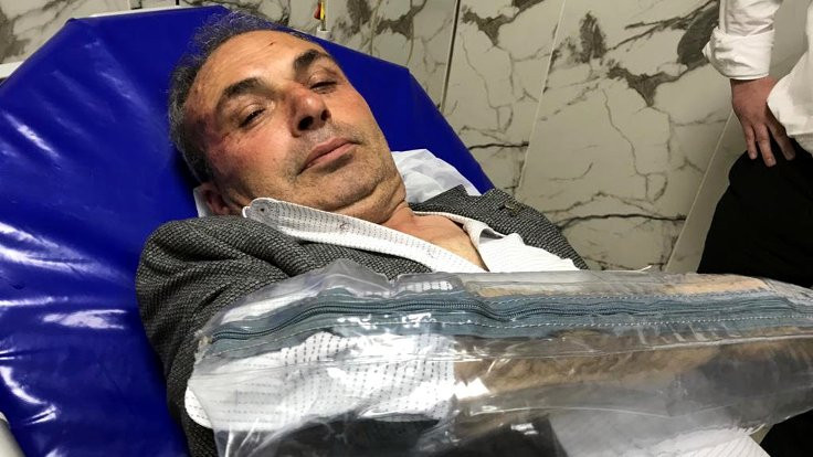 CHP'li belediye başkan yardımcısına saldırı