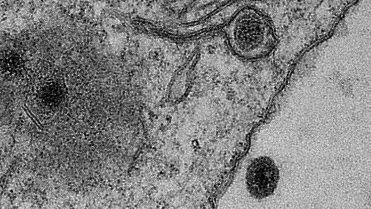 Genleri bilinenden farklı virüs keşfedildi