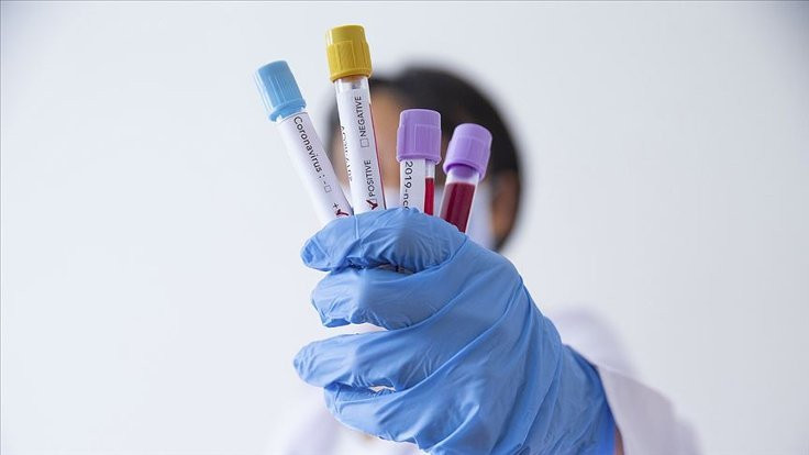 Korona virüsü testi yapılan 25 hastane