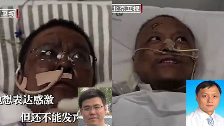 Korona tedavisi gören iki Wuhanlı doktorun ten rengi değişti