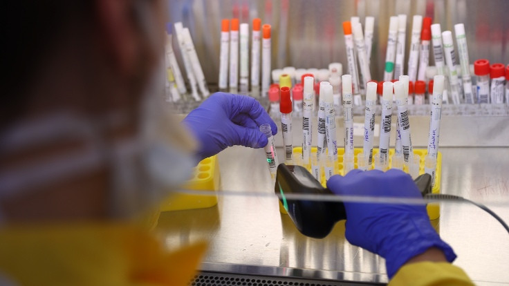 Korona virüsü test sonuçları gizleyen 2 laboratuvar için suç duyurusu