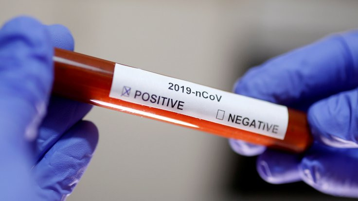 KKTC'de 17 gündür korona virüsü vakası tespit edilmedi