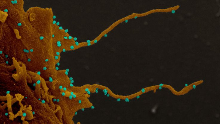 Enfekte hücreler virüsü yayan uzantılar üretiyor