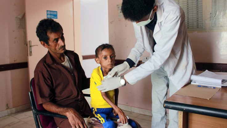Yemen'de 'gizli kolera ölümleri'