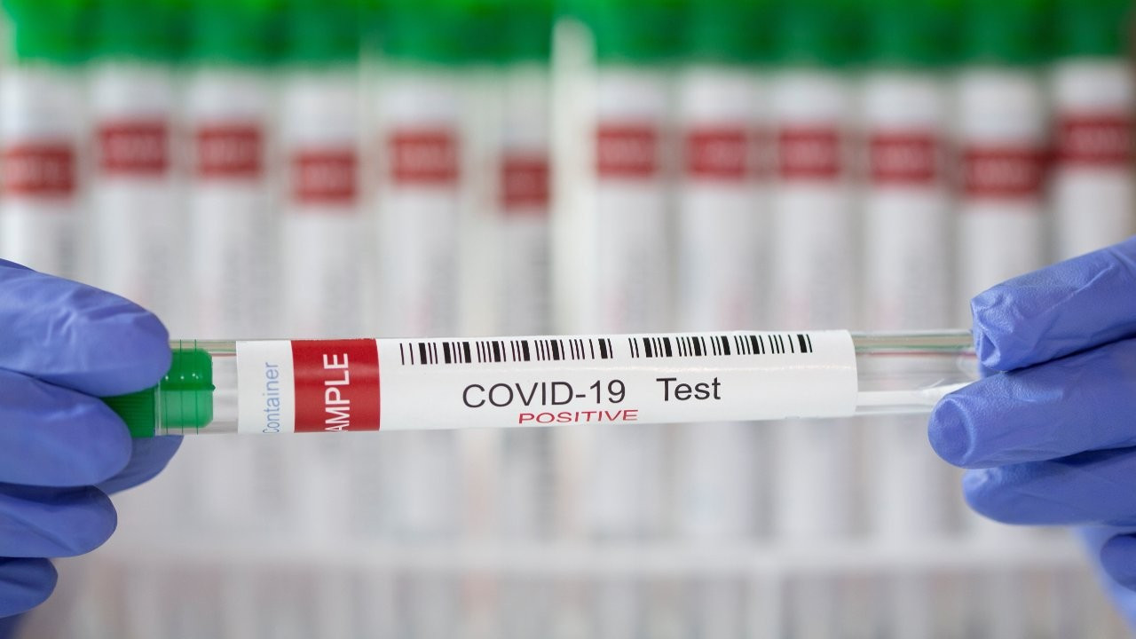 İspanya'da sahte negatif PCR testi satan eczacı tutuklandı