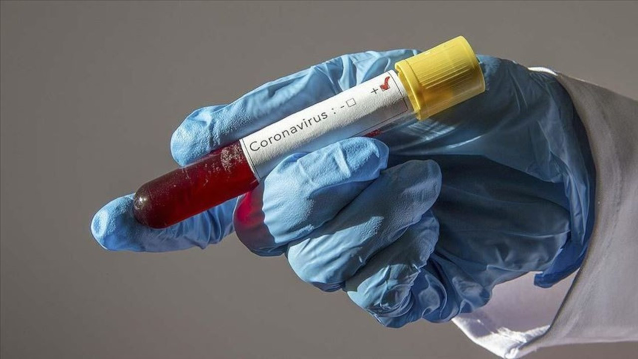 Korona virüsü salgını: 48 kişi öldü, 7 bin 304 yeni vaka tespit edildi