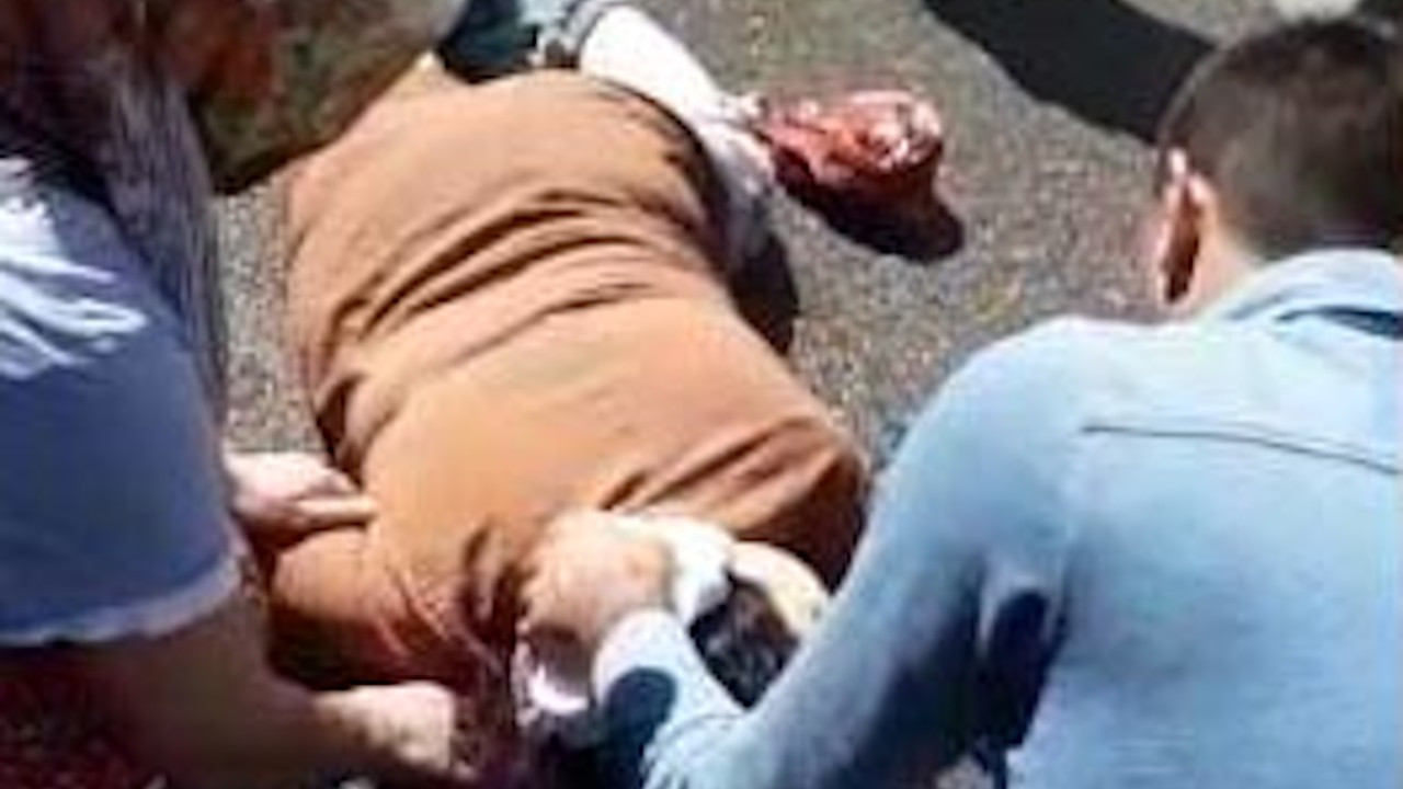 Kocaeli'de sokakta eşinin silahlı saldırısına uğrayan kadın yaralandı