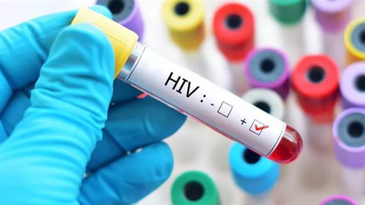 AIDS'e karşı yeni umut: Maymunlarda HIV'i öldüren aşı geliştirildi