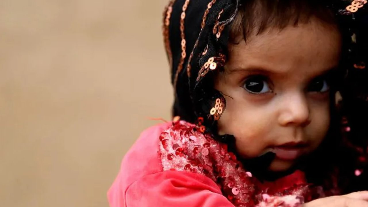 Afganistan'da yoksulluk: 'Anneler bebeklerini satmak zorunda kalıyor'