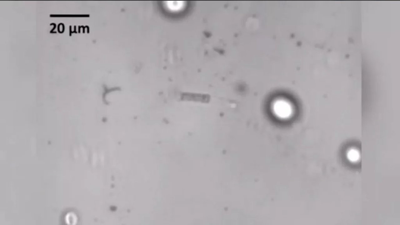 Araştırma: Korona virüsü sperm sayısı ve kalitesini düşürüyor
