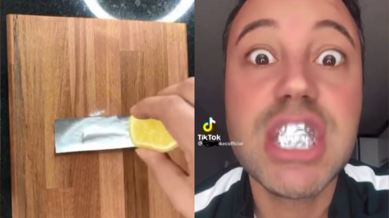 Sosyal medyada 'diş beyazlatma' akımı: Ölüme kadar götürebilir