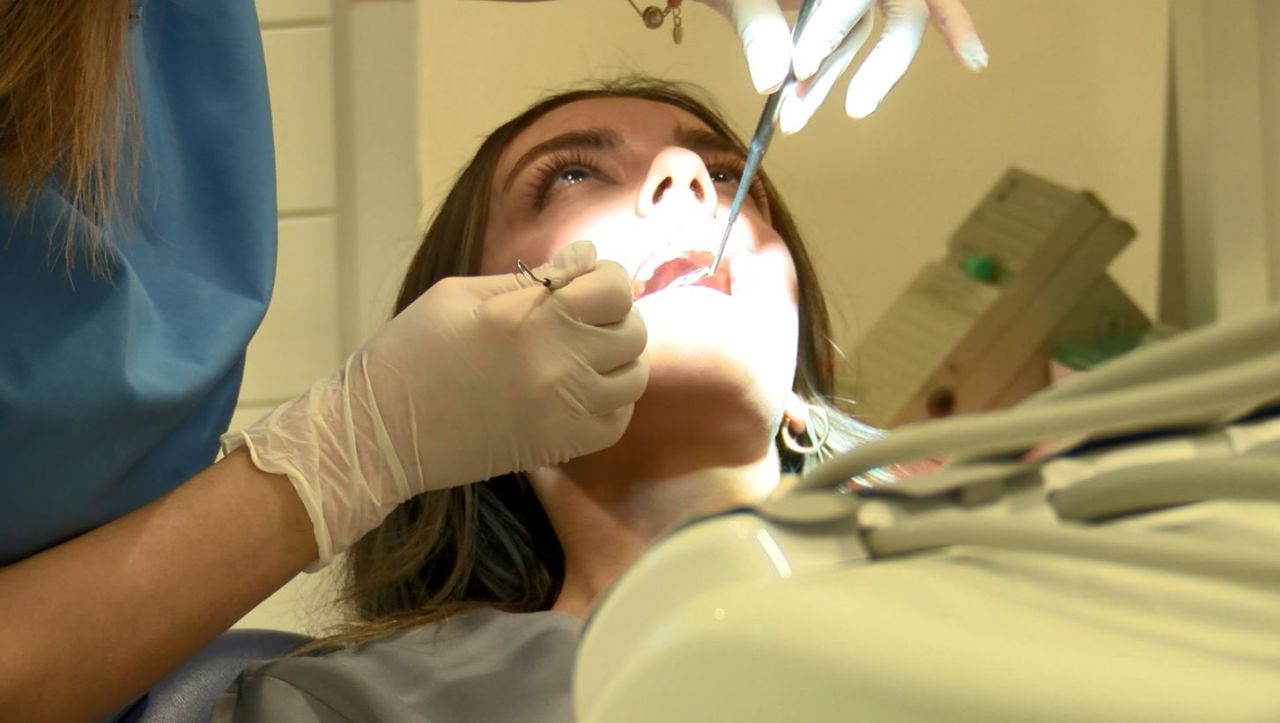 Sosyal medyada 'diş beyazlatma' akımı: Ölüme kadar götürebilir - Sayfa 3