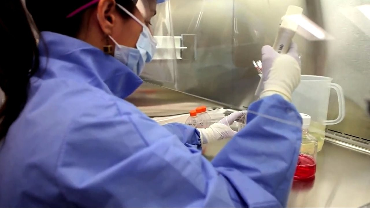 İlk kez bir kadın, kök hücre nakliyle HIV'i atlattı