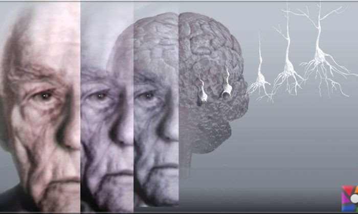 Araştırma: Alzheimer olasılığı kan gruplarına göre değişiyor - Sayfa 2