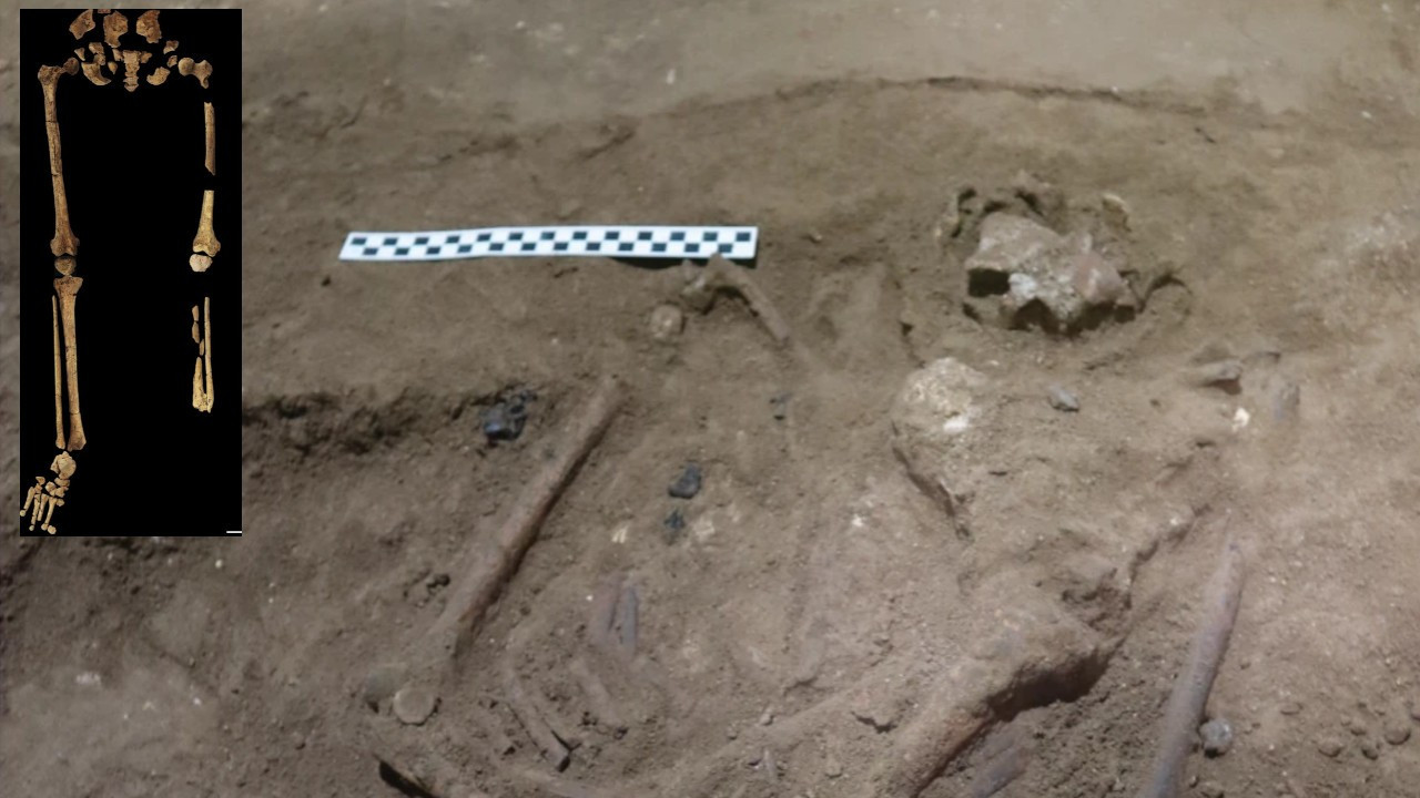 Dünyanın bilinen en eski amputesi bulundu: 31 bin yaşında