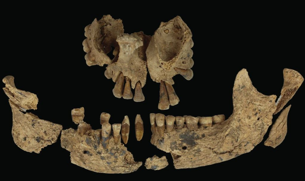 Dünyanın bilinen en eski amputesi bulundu: 31 bin yaşında - Sayfa 4
