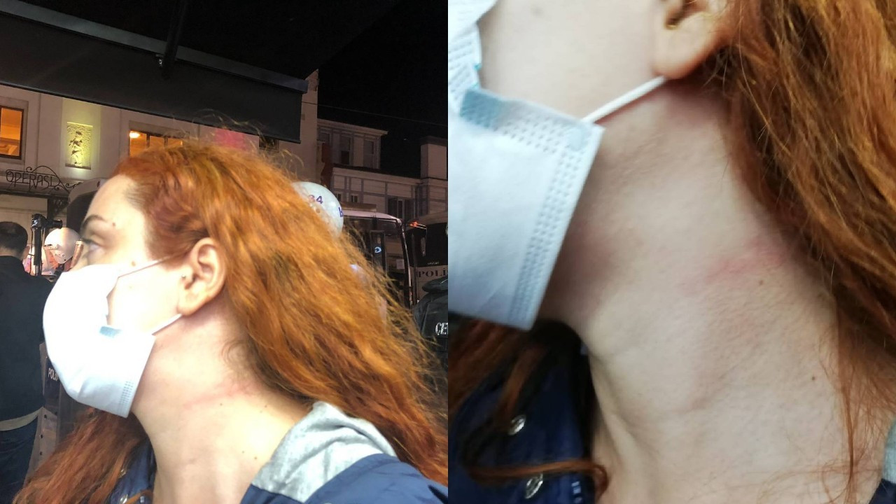 Polisin boğazını sıktığı gazeteci Nazlıer: Duyulmasını istemiyorlar