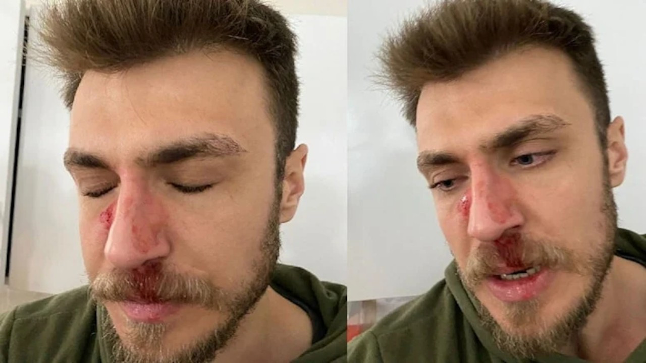 İzmir'de doktora saldırı: 'Eşime bakamazsın' deyip yumruk attı