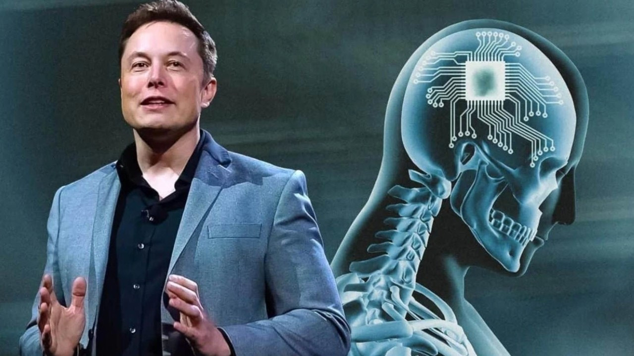 Elon Musk'ın beyin çipi projesinde insan deneyleri başlıyor