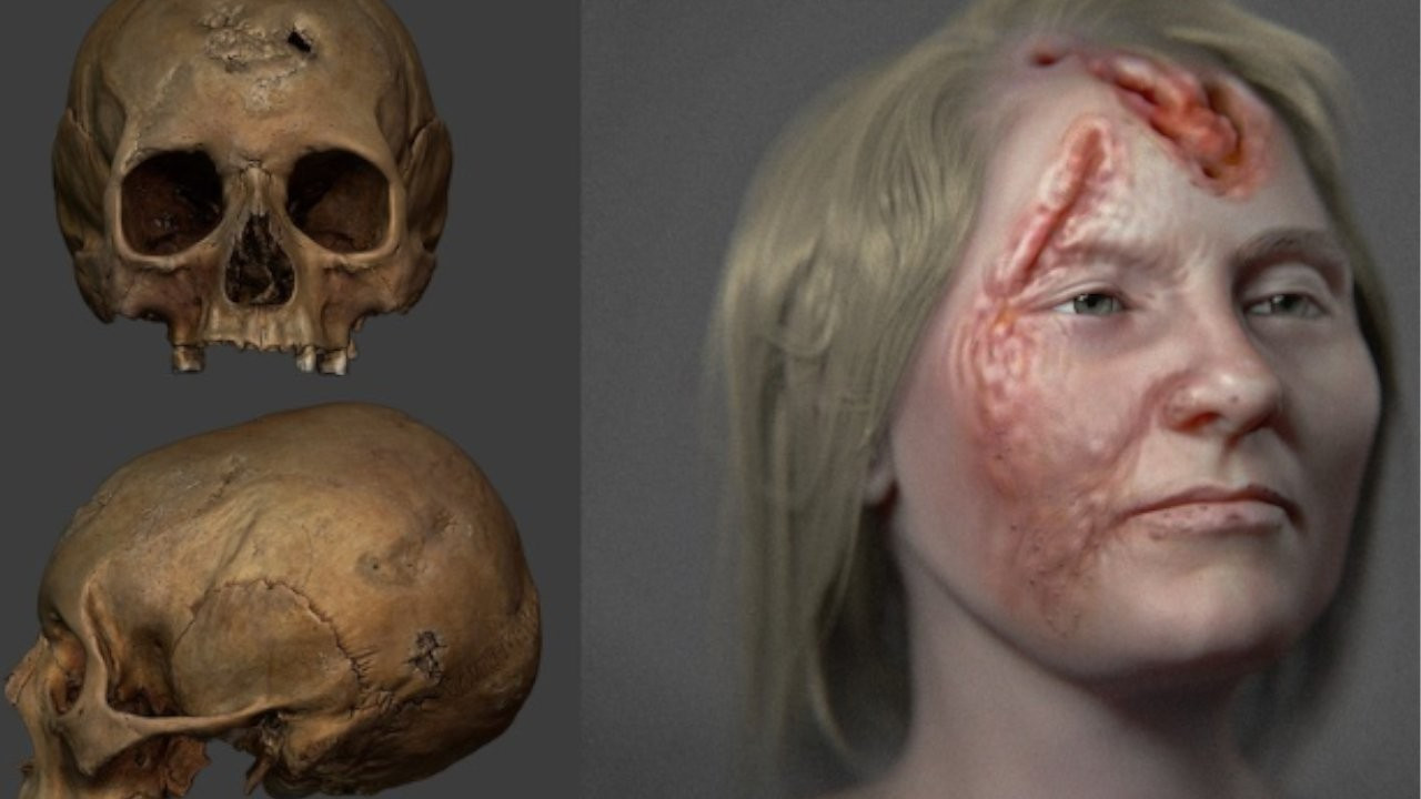 500 yıl önce frengi olan kadının yüzü