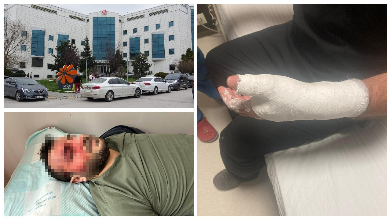 Ameliyat sonrası 4 doktor kavga etti: 2 yaralı
