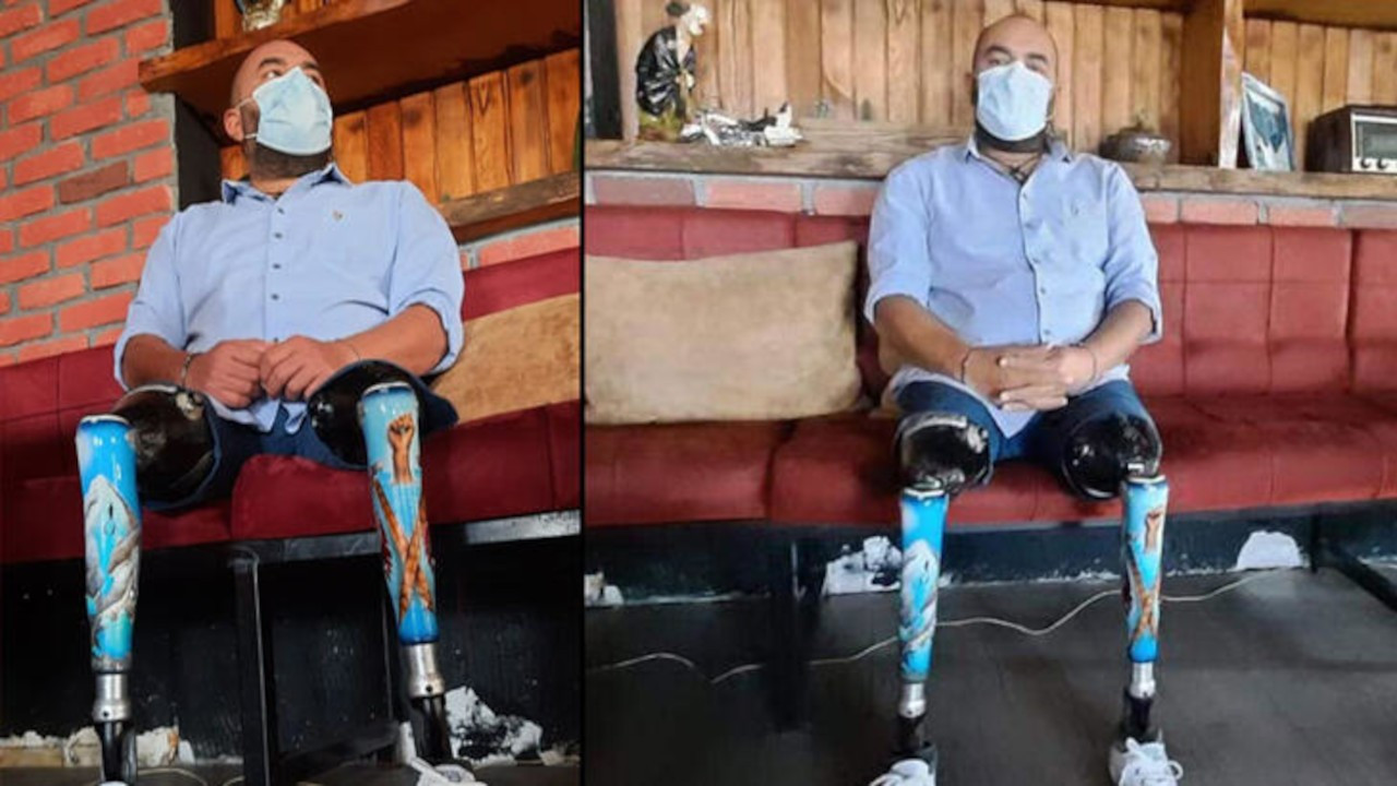 17 Ağustos'ta iki bacağını kaybeden Koçak deprem bölgesinde