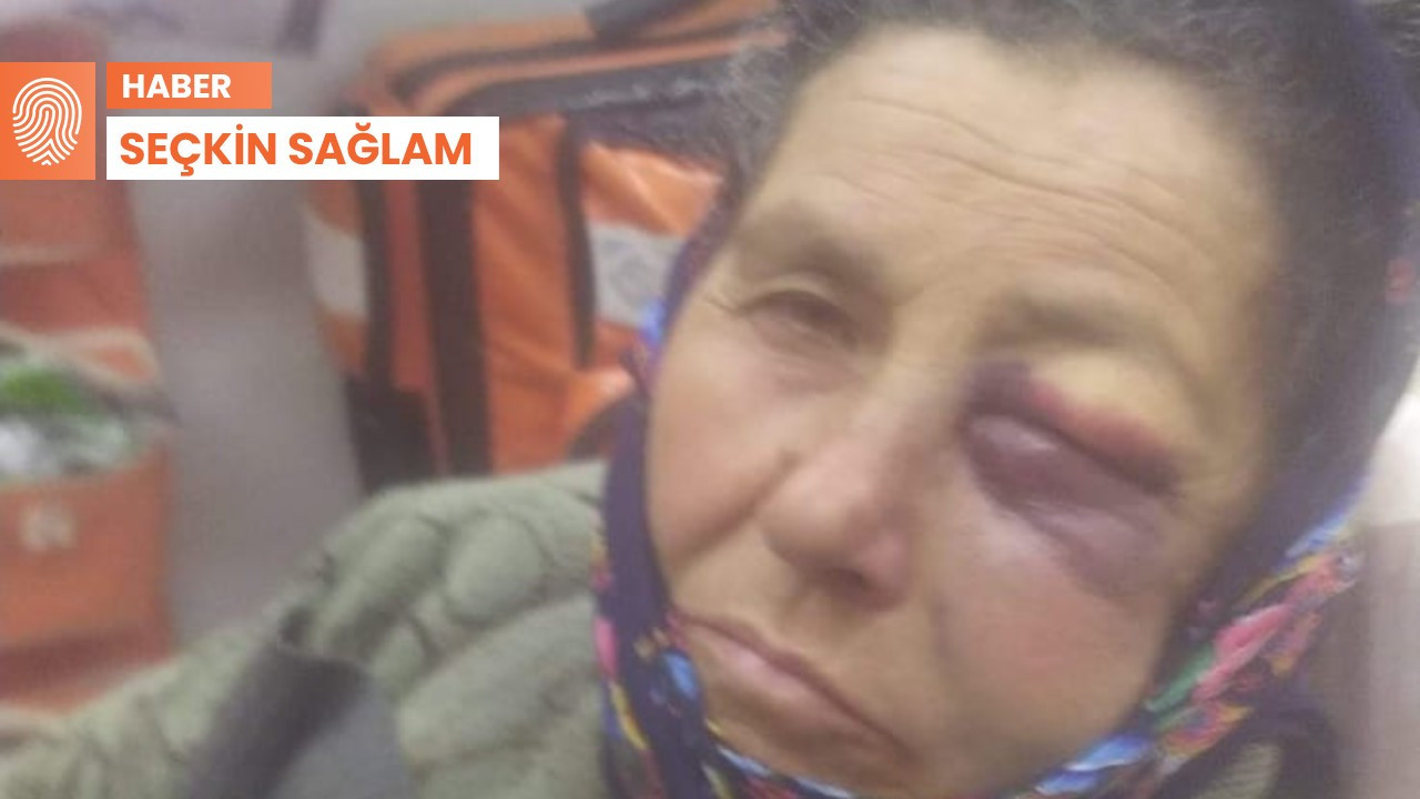 70 yaşındaki depremzedeye şiddet: Yüzünde kırıklar var