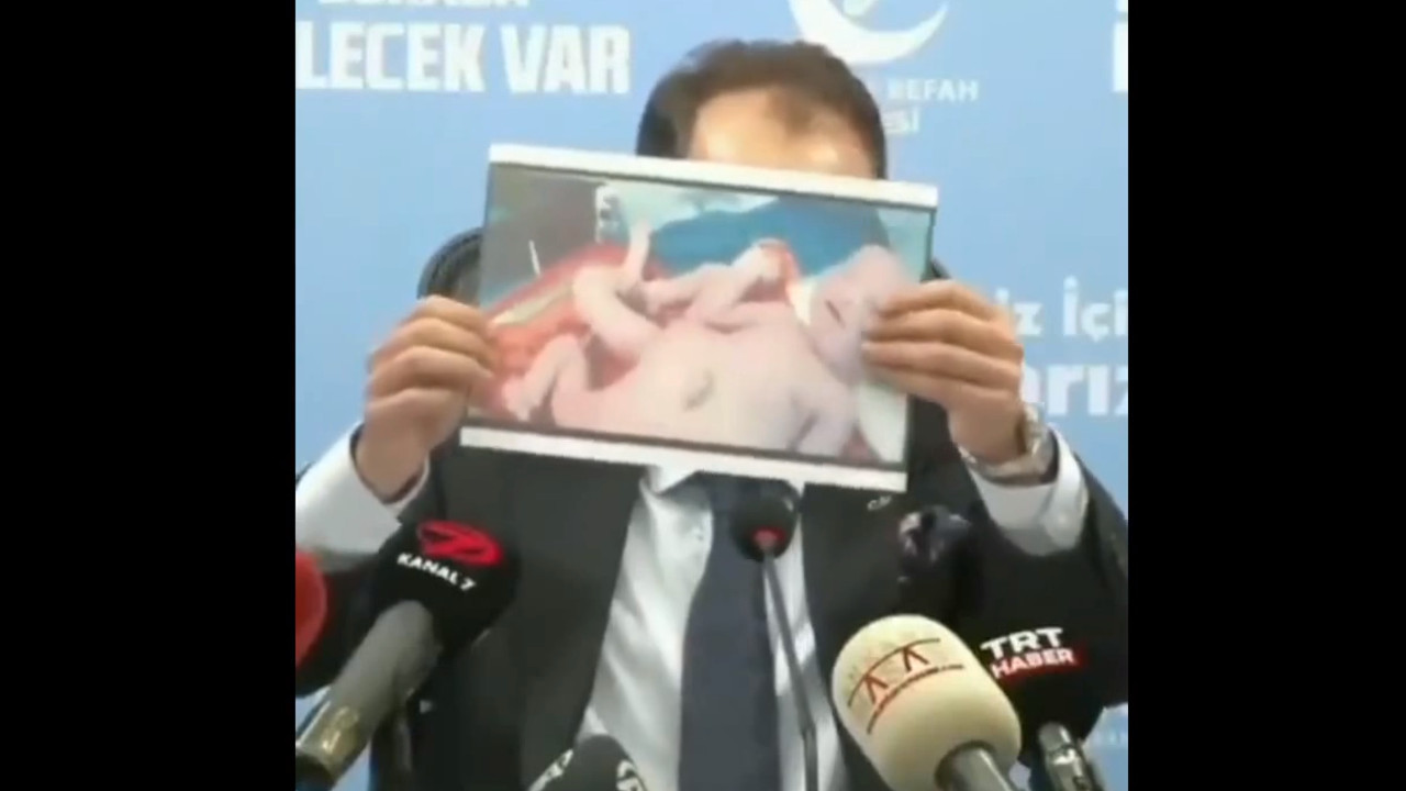 Fatih Erbakan'ın 'kuyruklu bebek' videosu sosyal medyada viral oldu