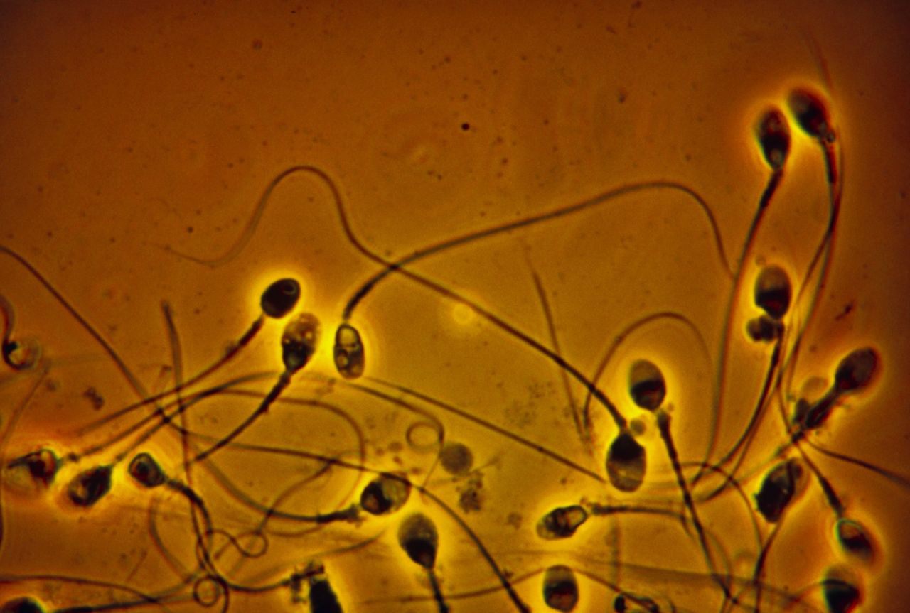 Sperm sayısını ve kalitesini neler etkiliyor? - Sayfa 1