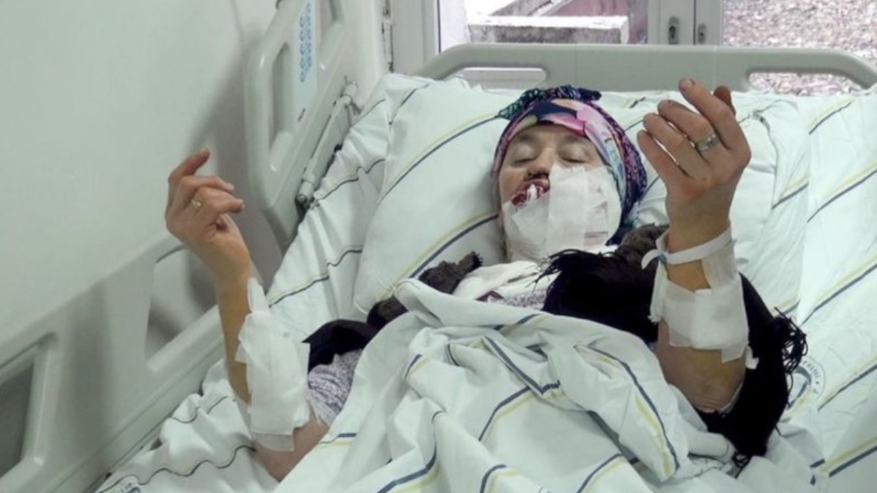 Erzurum'da 4 kişiyi yaralan kurt kuduz çıktı