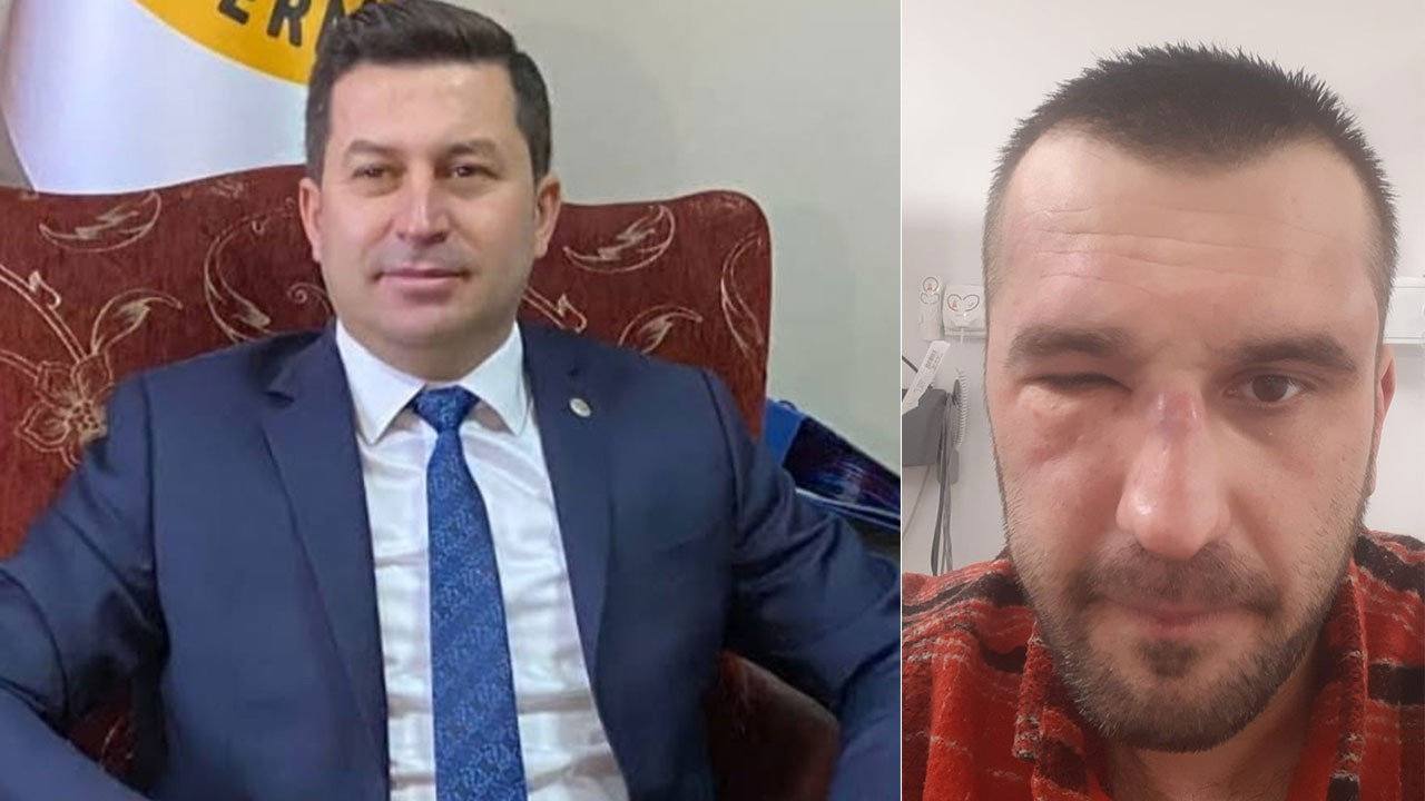 AK Partili belediye başkanının koruması ve şoföründen sopalı saldırı
