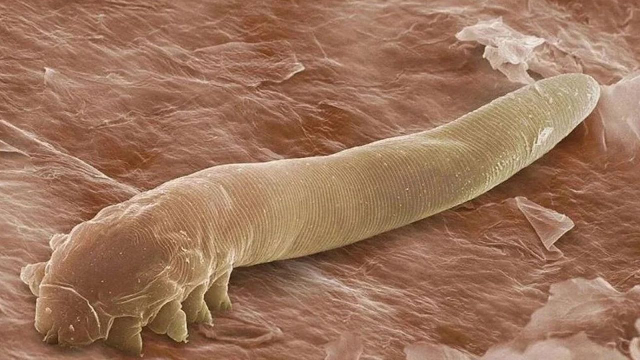İnsan derisinde 2,5 milyon tane yaşıyor: Temasla bulaşan mikroskobik akar - Sayfa 2