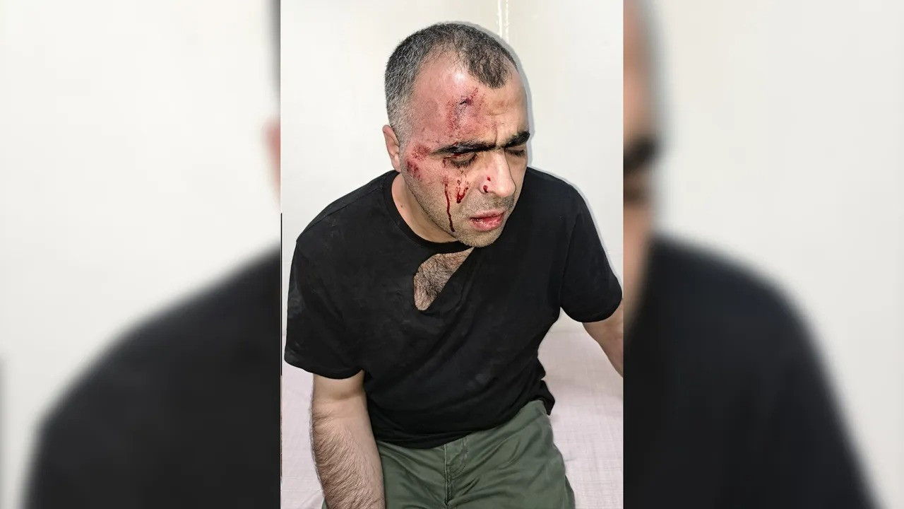15 barodan gazeteci Sinan Aygül’e saldırıya kınama