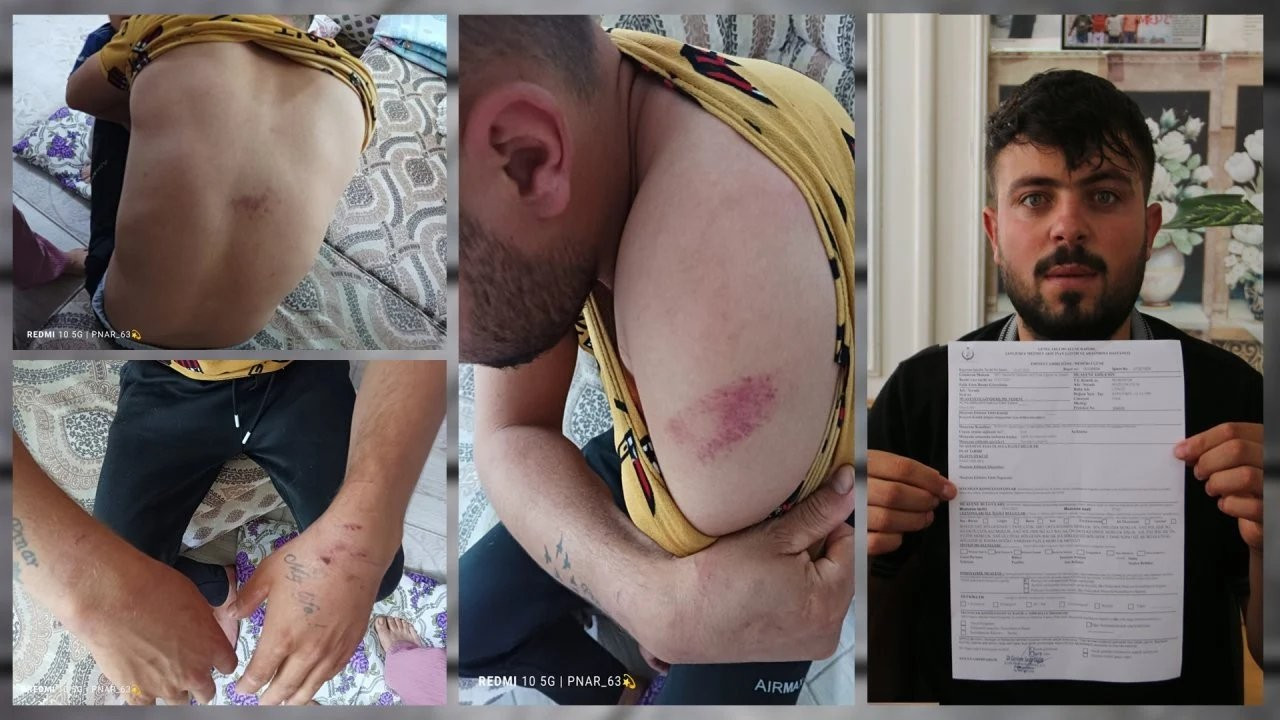 Urfa'da kaçırılan genç: İşkence gördüm, şikayetim kabul edilmedi