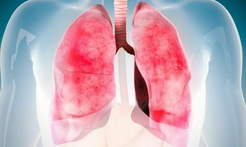 Akciğerlerinizin son durumunu ele veren 4 sinyal - Sayfa 2