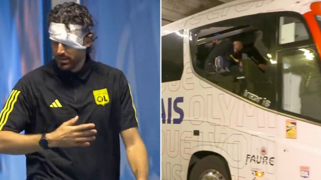 Olimpik Lyon takım otobüsüne taşlı saldırı: Grosso yaralandı