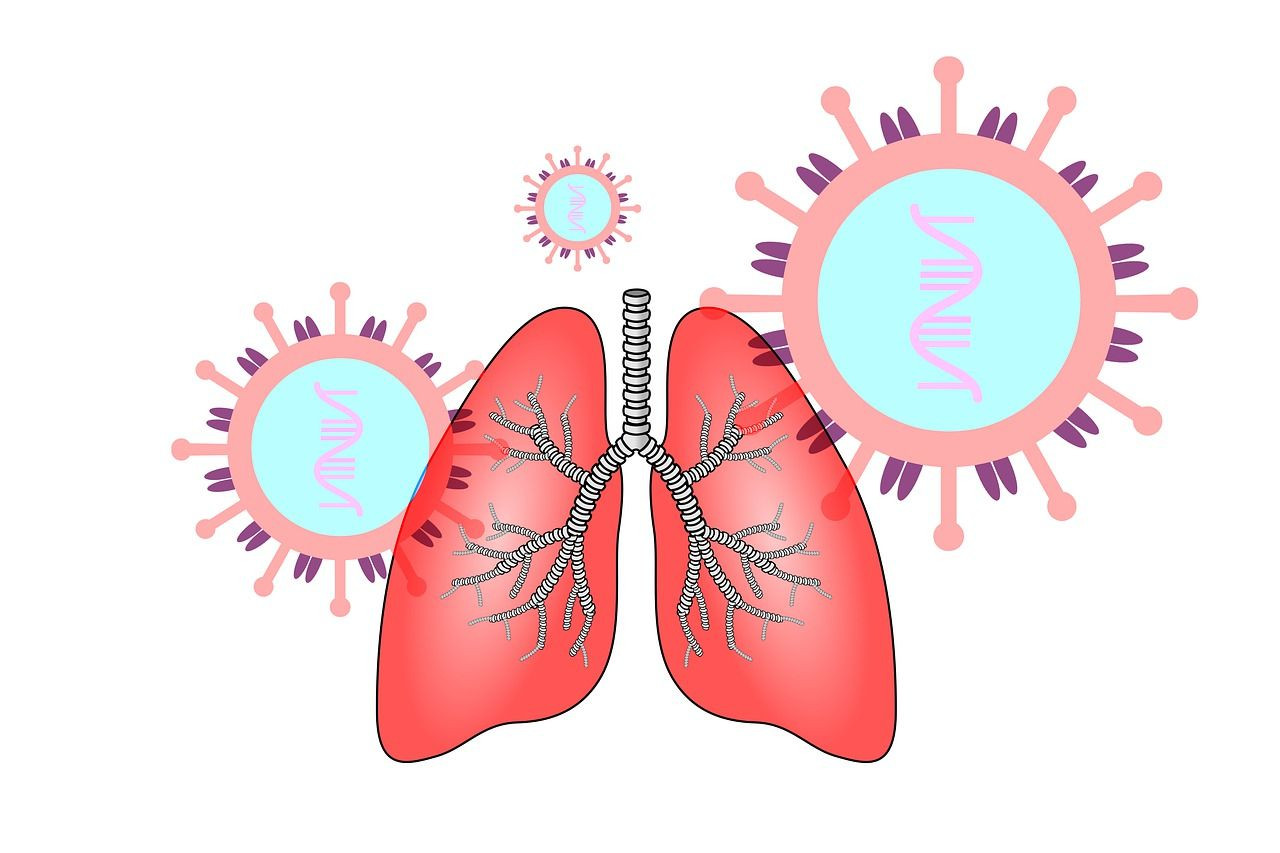 Akciğer kanserinin 10 önemli sinyali: İnatçı öksürük de alarm olabilir - Sayfa 2